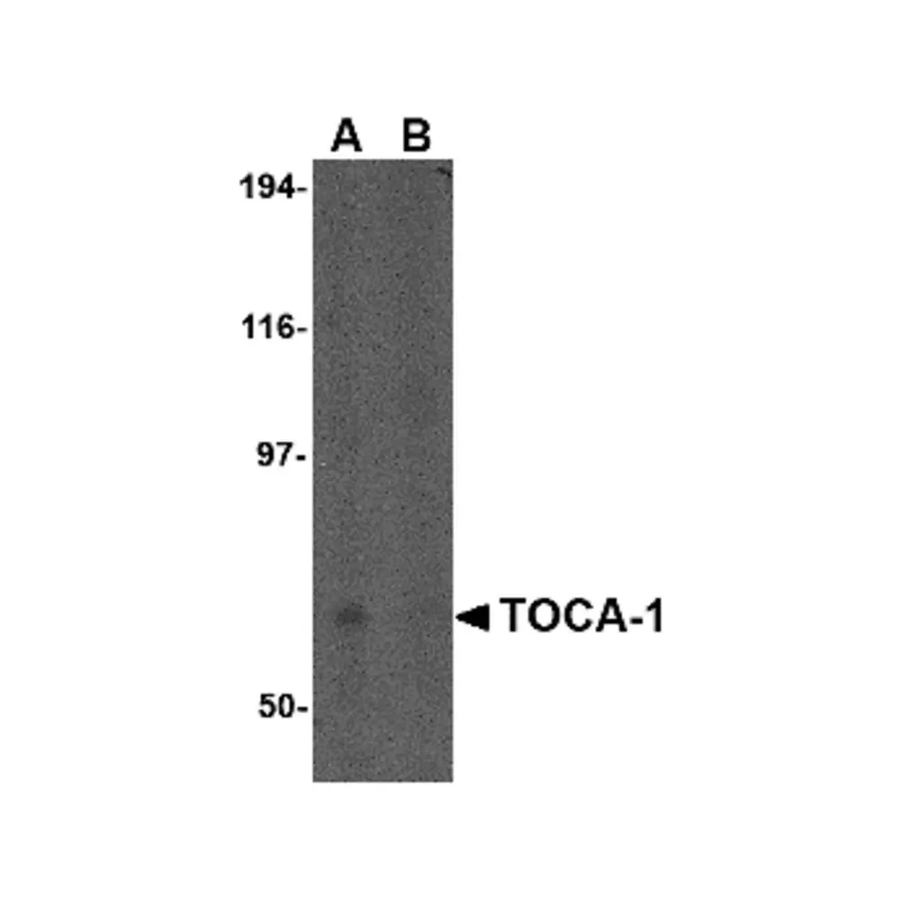 ProSci 4375 TOCA-1 Antibody, ProSci, 0.1 mg/Unit Primary Image