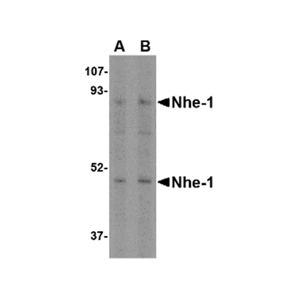 ProSci 4377_S Nhe-1 Antibody, ProSci, 0.02 mg/Unit Primary Image