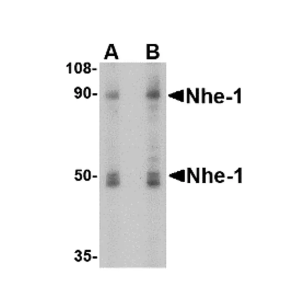 ProSci 4379 Nhe-1 Antibody, ProSci, 0.1 mg/Unit Primary Image