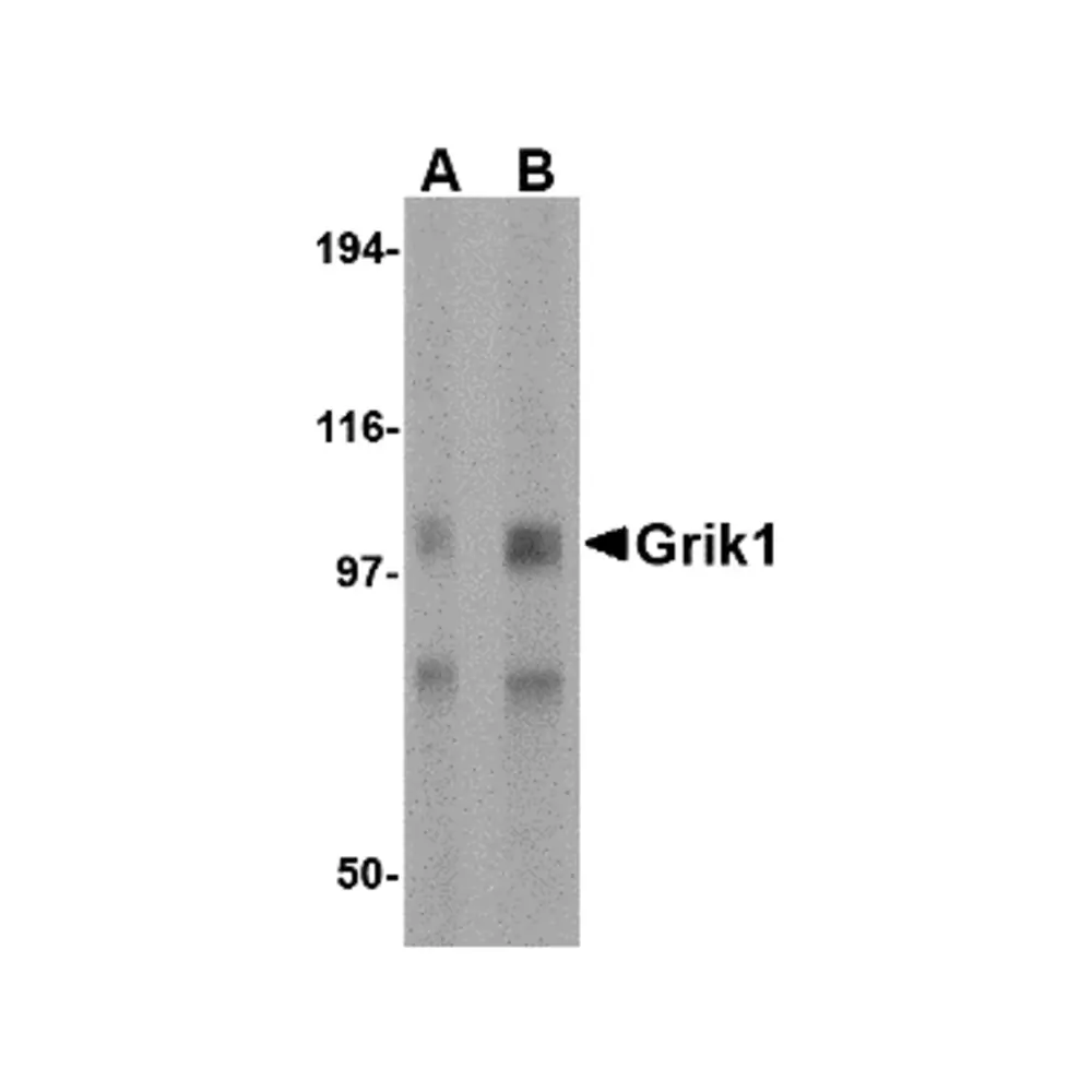 ProSci 4383 Grik1 Antibody, ProSci, 0.1 mg/Unit Primary Image