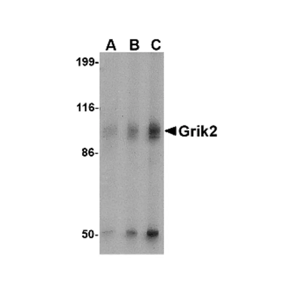 ProSci 4387_S Grik2 Antibody, ProSci, 0.02 mg/Unit Primary Image