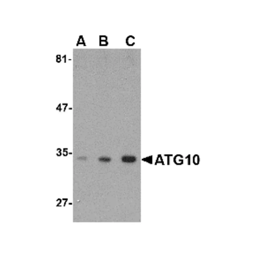 ProSci 4399 ATG10 Antibody, ProSci, 0.1 mg/Unit Primary Image