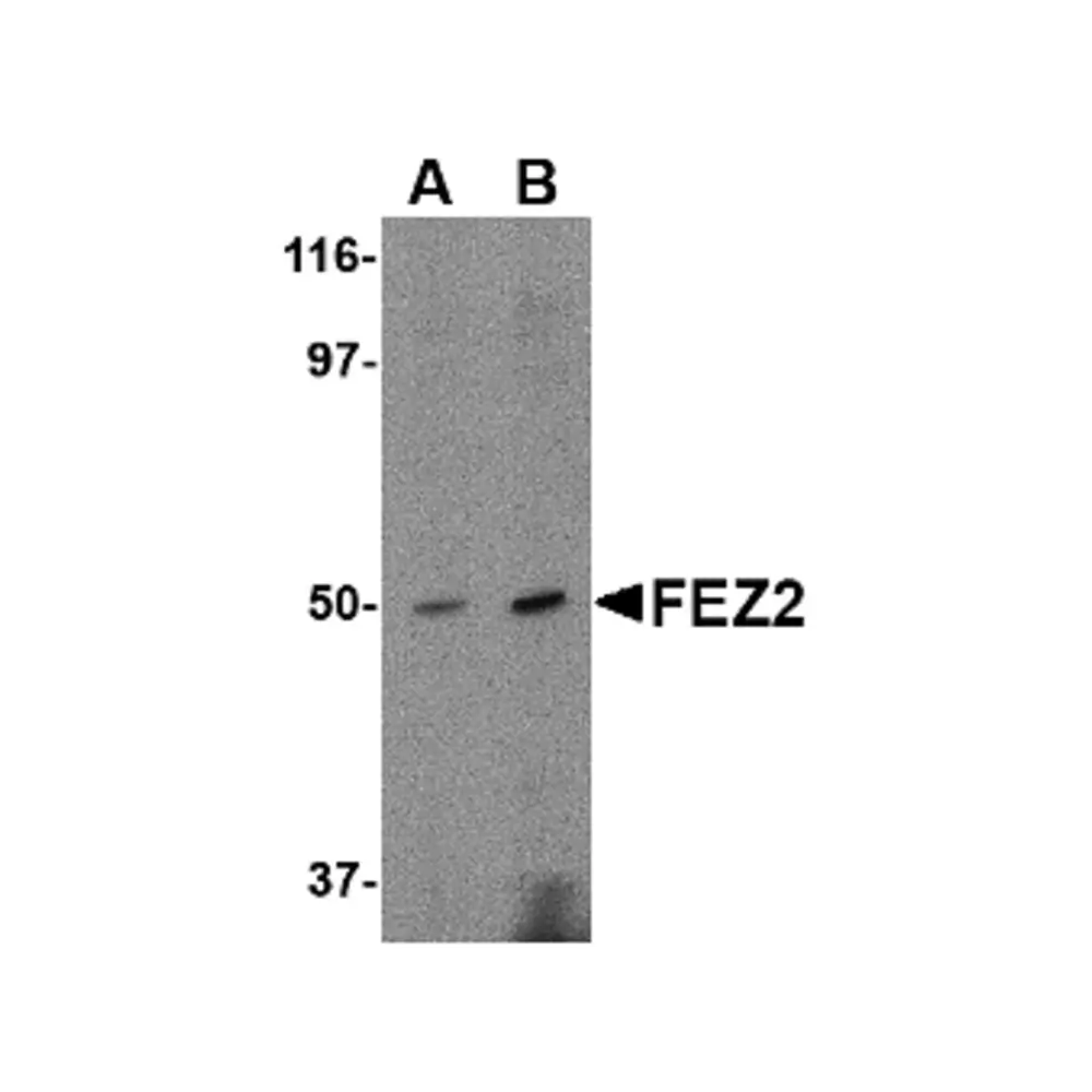 ProSci 4403 FEZ2 Antibody, ProSci, 0.1 mg/Unit Primary Image