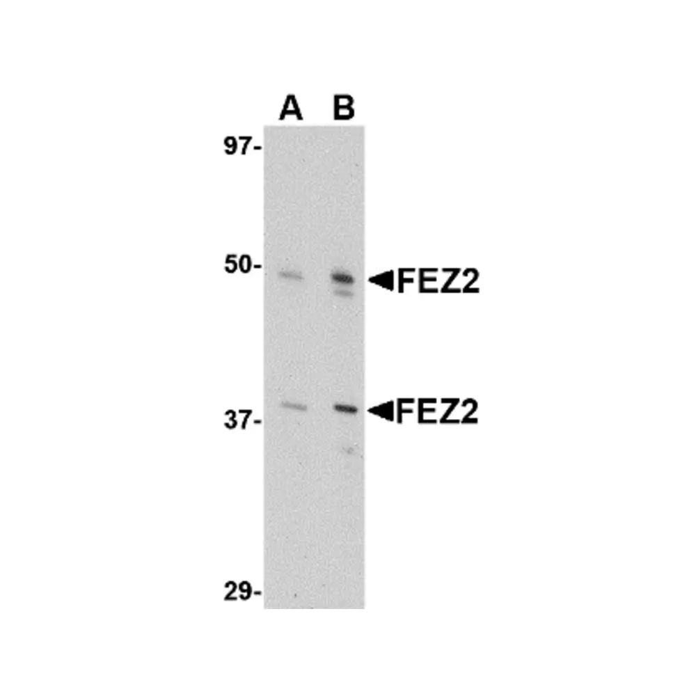 ProSci 4405 FEZ2 Antibody, ProSci, 0.1 mg/Unit Primary Image