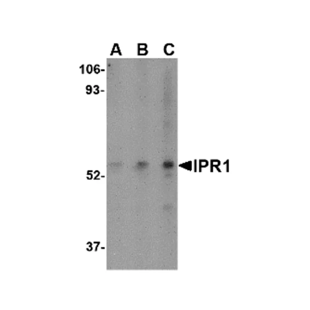 ProSci 4407_S IPR1 Antibody, ProSci, 0.02 mg/Unit Primary Image
