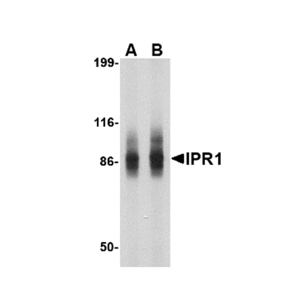ProSci 4409 IPR1 Antibody, ProSci, 0.1 mg/Unit Primary Image