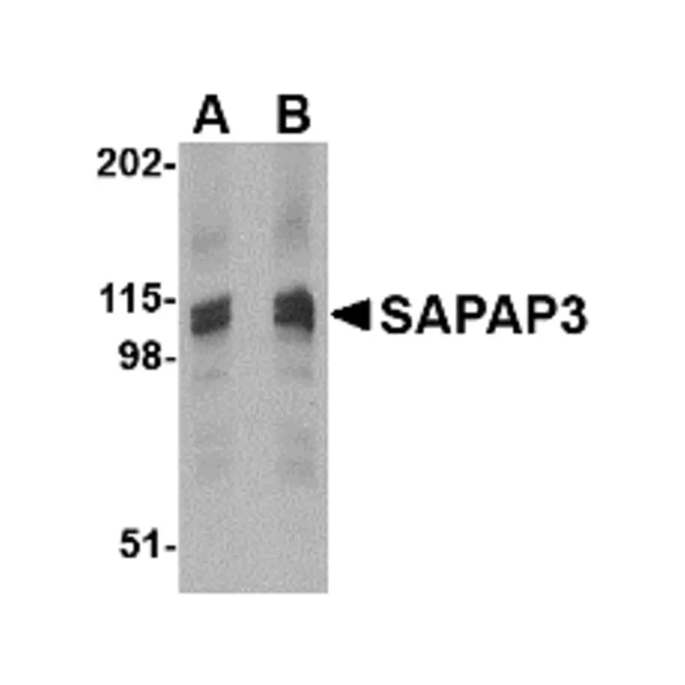 ProSci 4411 SAPAP3 Antibody, ProSci, 0.1 mg/Unit Primary Image