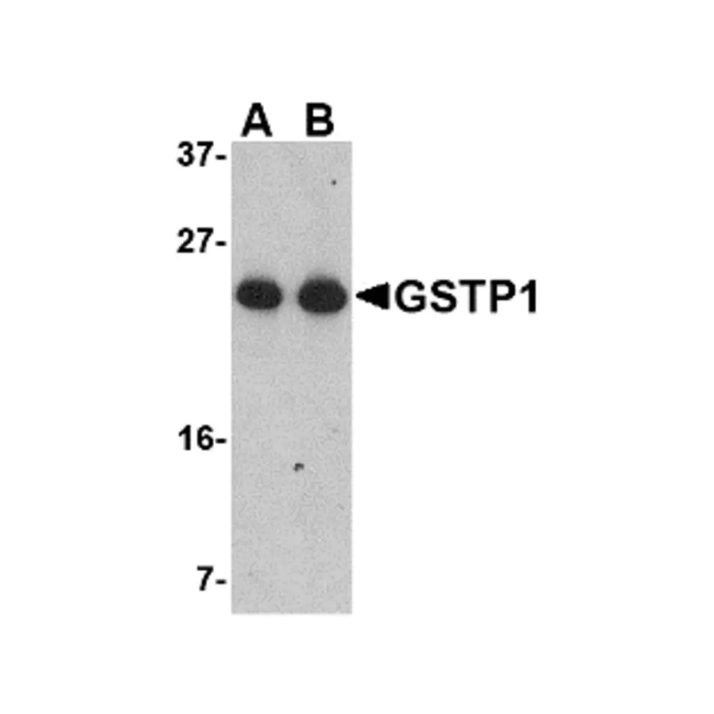 ProSci 4413_S GSTP1 Antibody, ProSci, 0.02 mg/Unit Primary Image