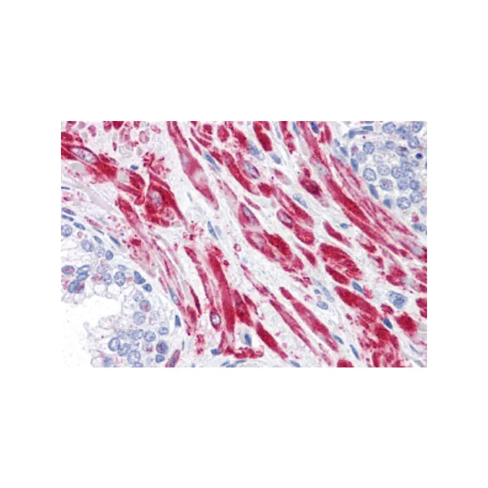 ProSci 4415_S TBC1D4 Antibody, ProSci, 0.02 mg/Unit Primary Image