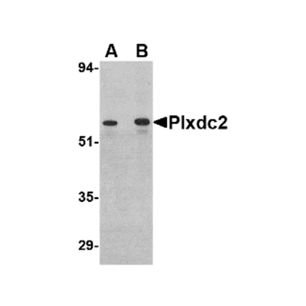 ProSci 4419_S Plxdc2 Antibody, ProSci, 0.02 mg/Unit Primary Image