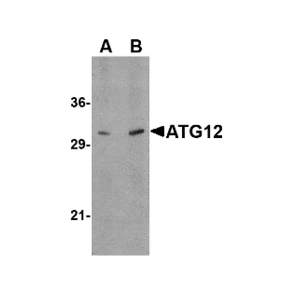 ProSci 4421 ATG12 Antibody, ProSci, 0.1 mg/Unit Primary Image