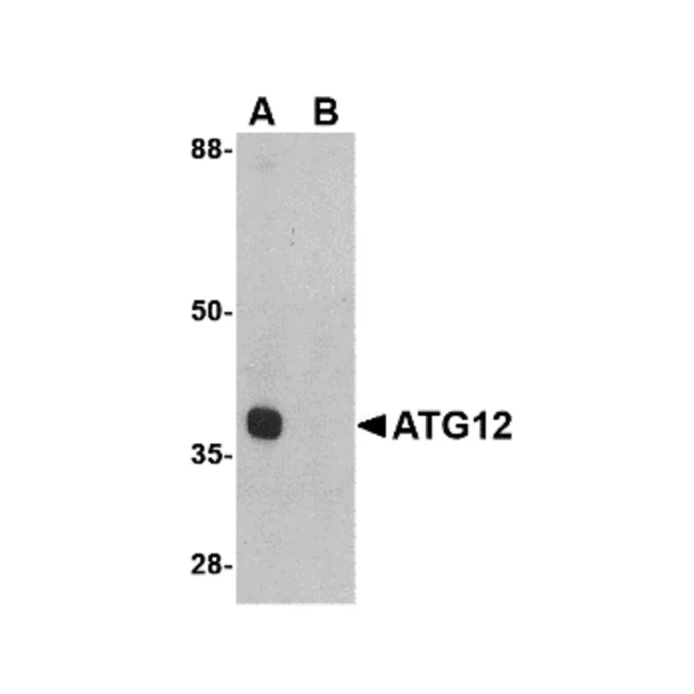 ProSci 4423 ATG12 Antibody, ProSci, 0.1 mg/Unit Primary Image