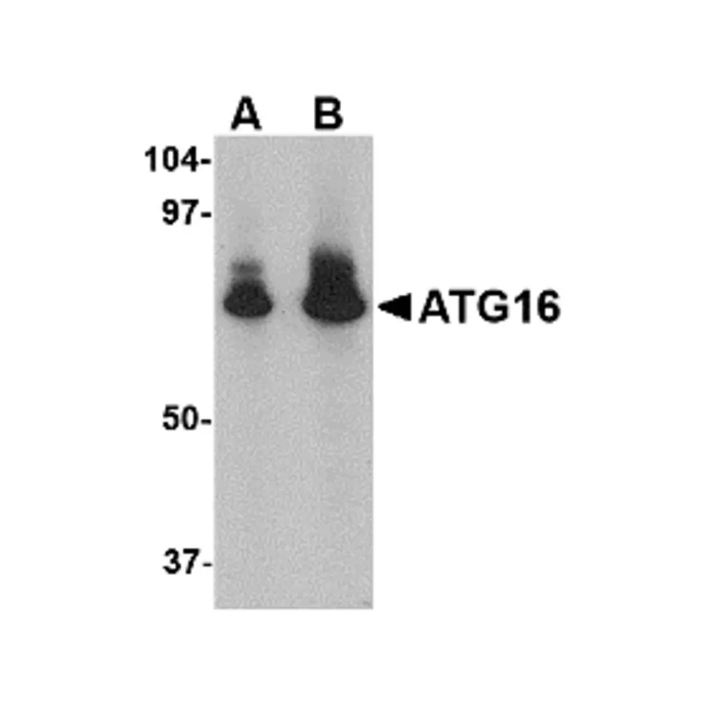 ProSci 4425 ATG16 Antibody, ProSci, 0.1 mg/Unit Primary Image