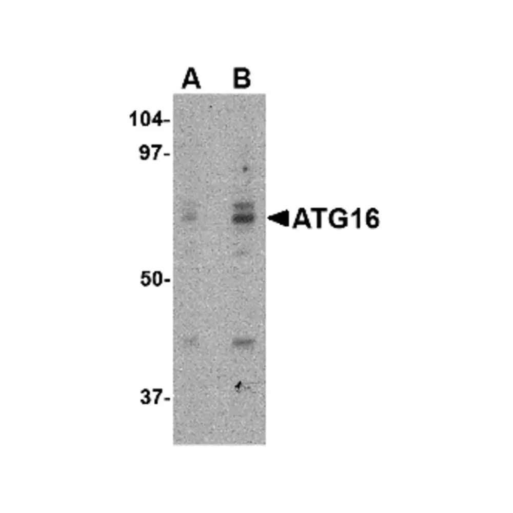 ProSci 4427 ATG16 Antibody, ProSci, 0.1 mg/Unit Primary Image