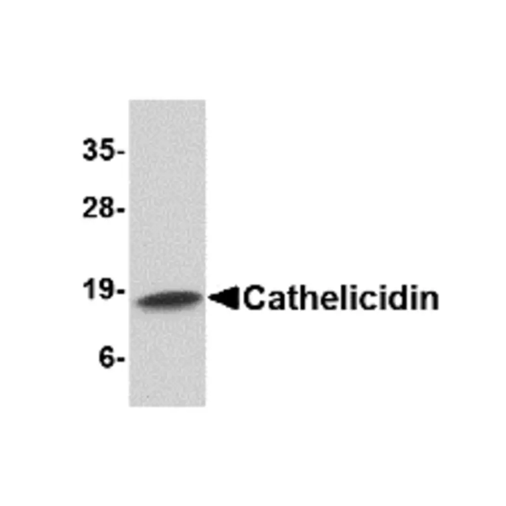 ProSci 4429_S Cathelicidin Antibody, ProSci, 0.02 mg/Unit Primary Image
