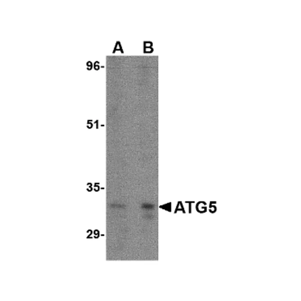 ProSci 4441 ATG5 Antibody, ProSci, 0.1 mg/Unit Primary Image