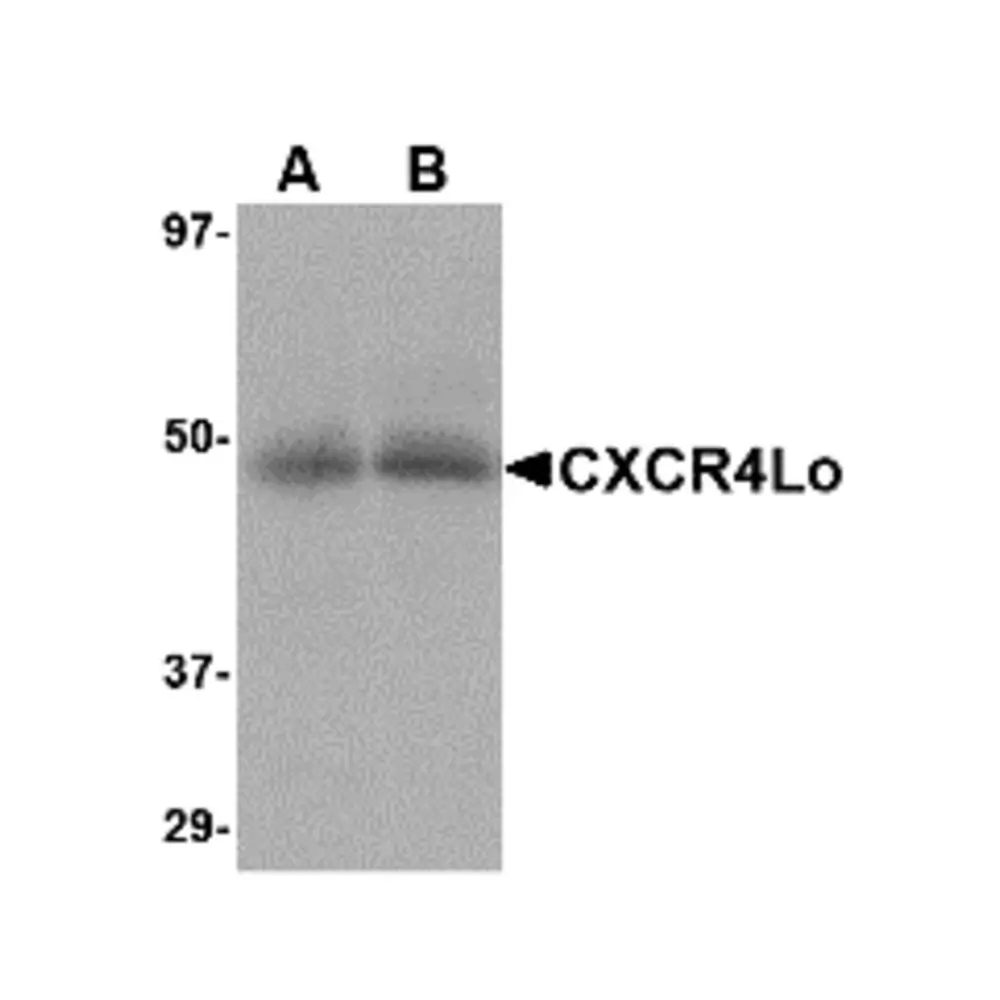 ProSci 4443 CXCR4-Lo Antibody, ProSci, 0.1 mg/Unit Primary Image