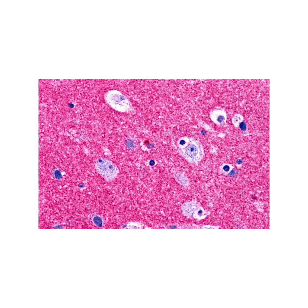 ProSci 4447_S RIM2 Antibody, ProSci, 0.02 mg/Unit Primary Image