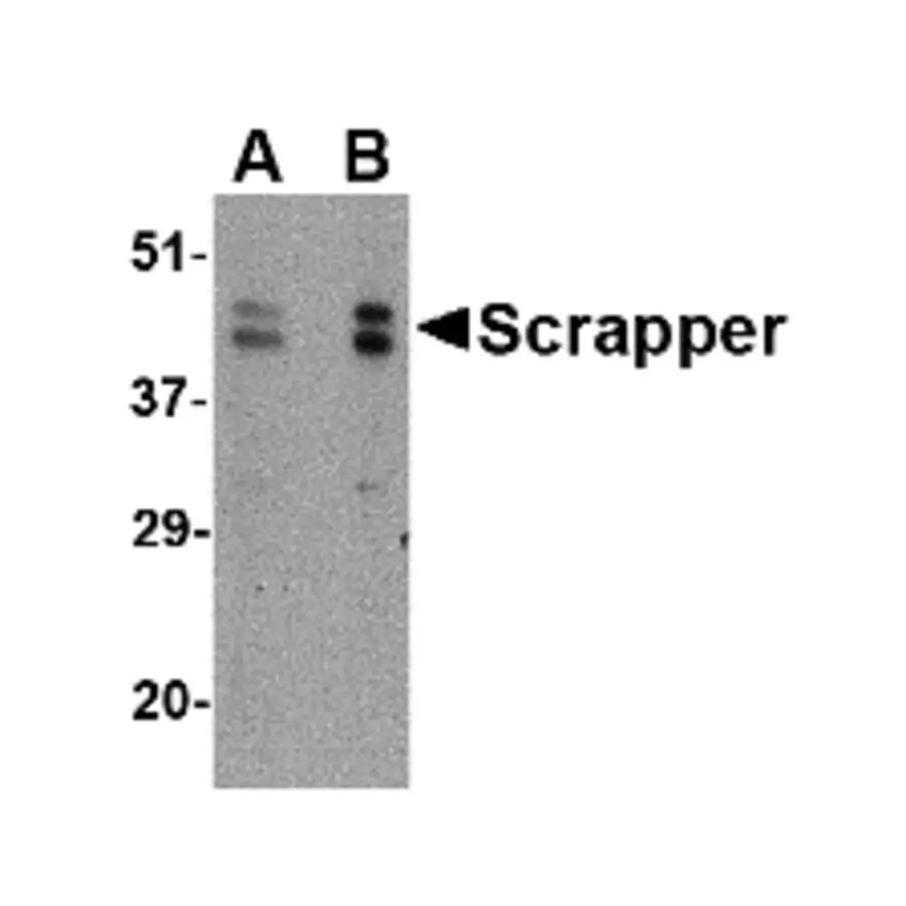 ProSci 4449 SCRAPPER Antibody, ProSci, 0.1 mg/Unit Primary Image