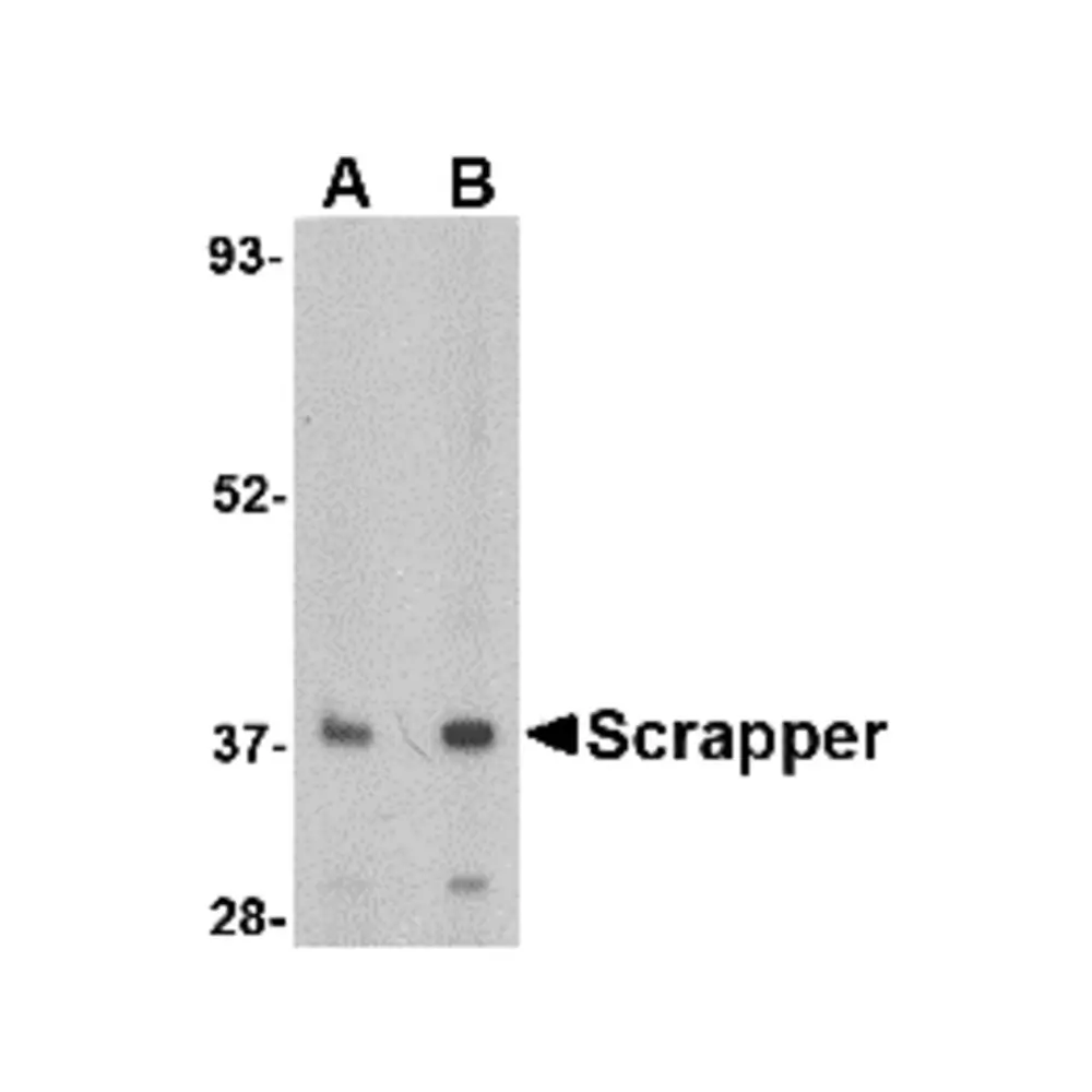 ProSci 4451 SCRAPPER Antibody, ProSci, 0.1 mg/Unit Primary Image