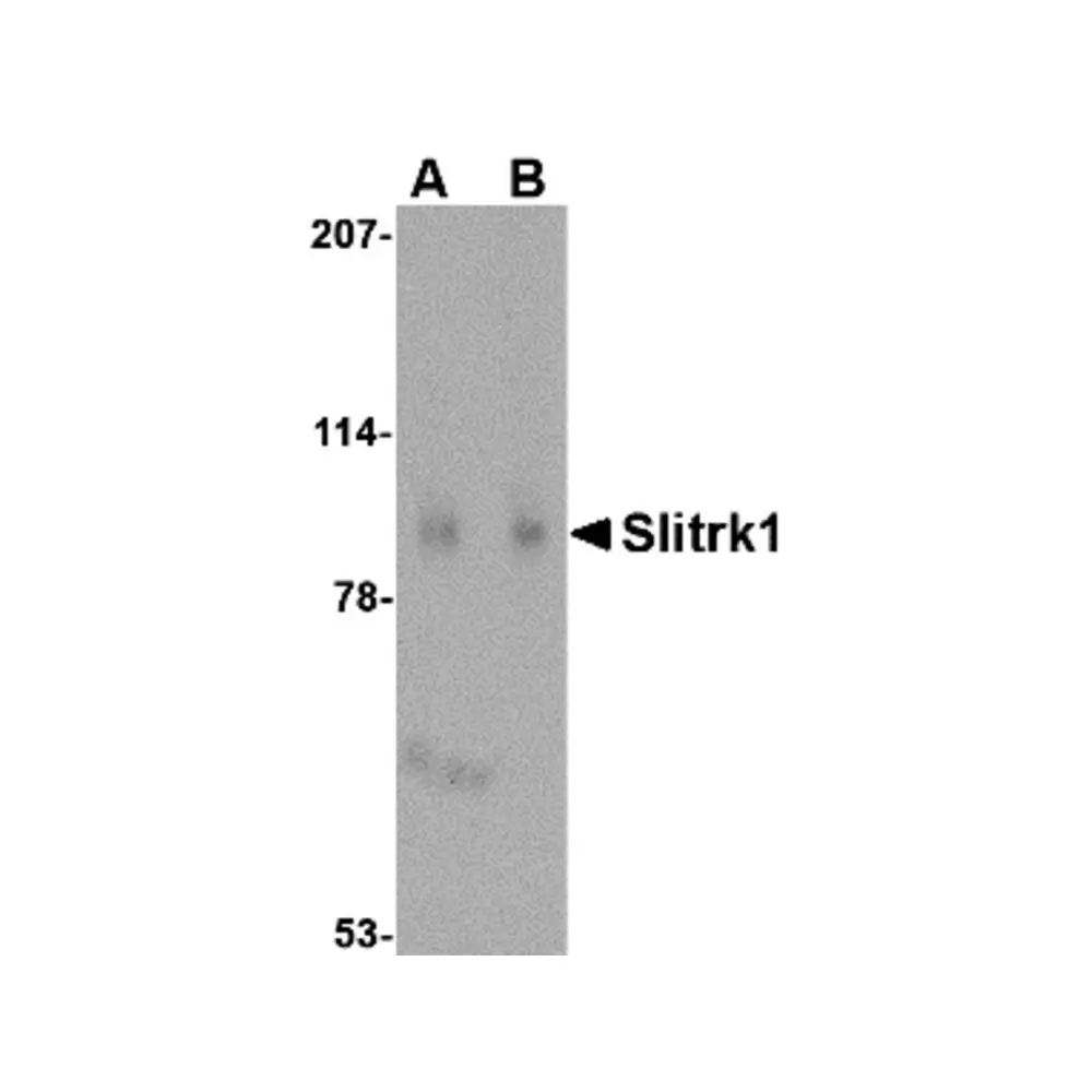 ProSci 4453_S Slitrk1 Antibody, ProSci, 0.02 mg/Unit Primary Image