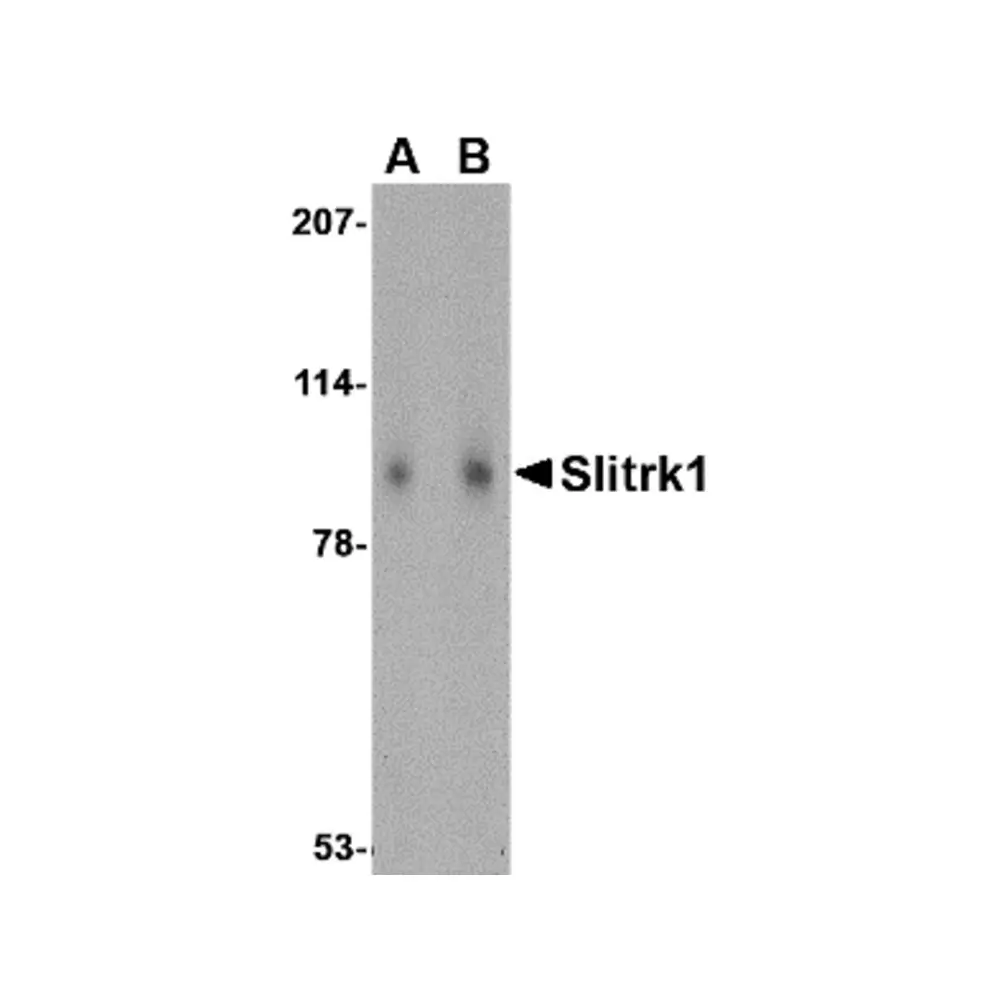 ProSci 4455_S Slitrk1 Antibody, ProSci, 0.02 mg/Unit Primary Image