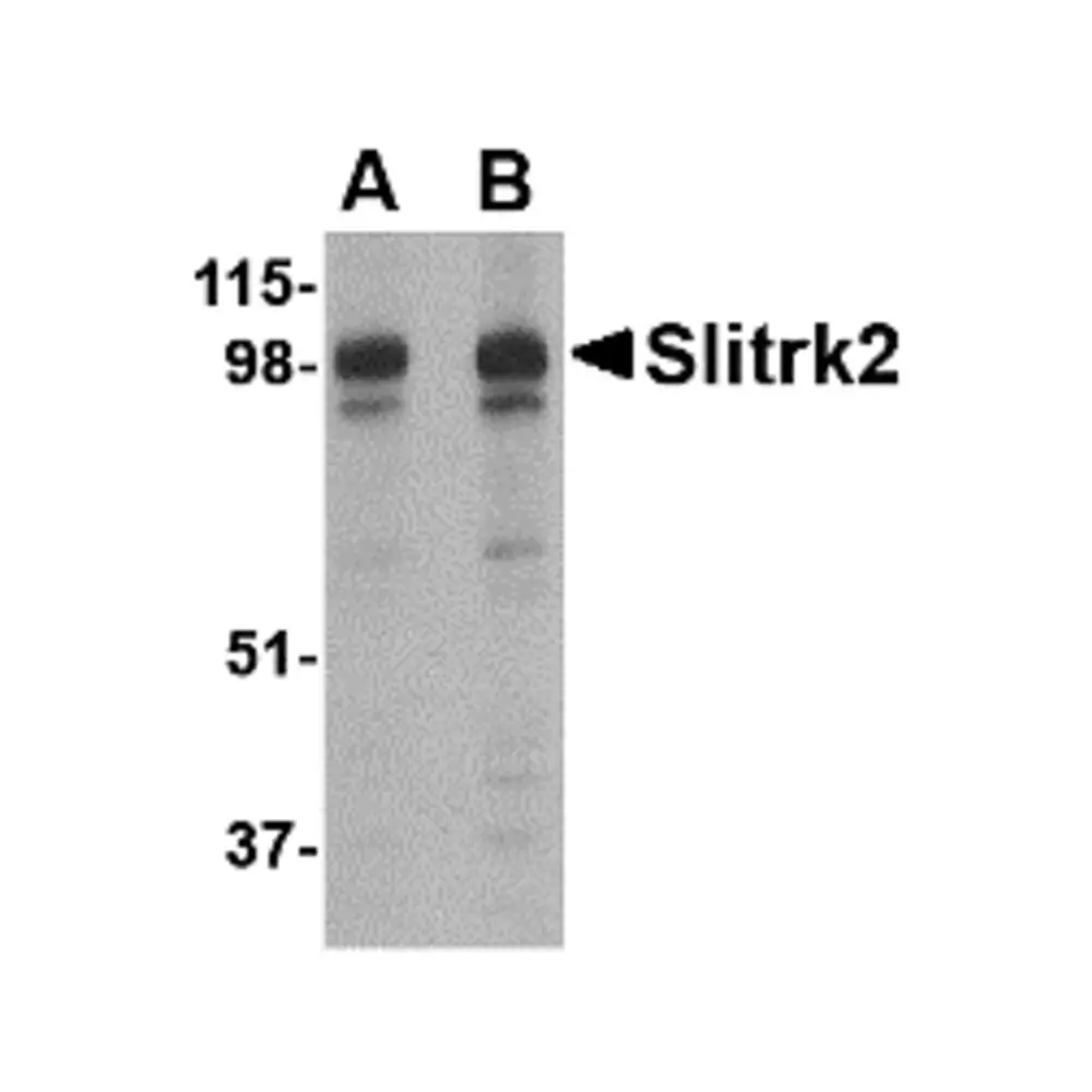 ProSci 4457 Slitrk2 Antibody, ProSci, 0.1 mg/Unit Primary Image