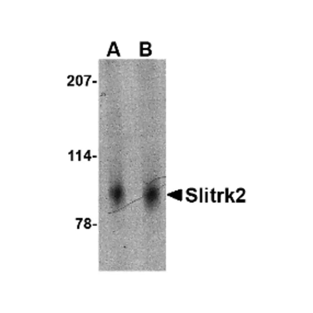 ProSci 4459 Slitrk2 Antibody, ProSci, 0.1 mg/Unit Primary Image