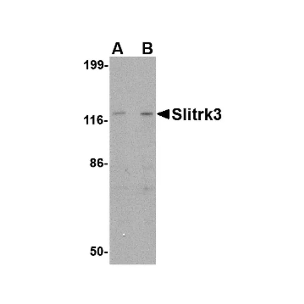 ProSci 4461 Slitrk3 Antibody, ProSci, 0.1 mg/Unit Primary Image