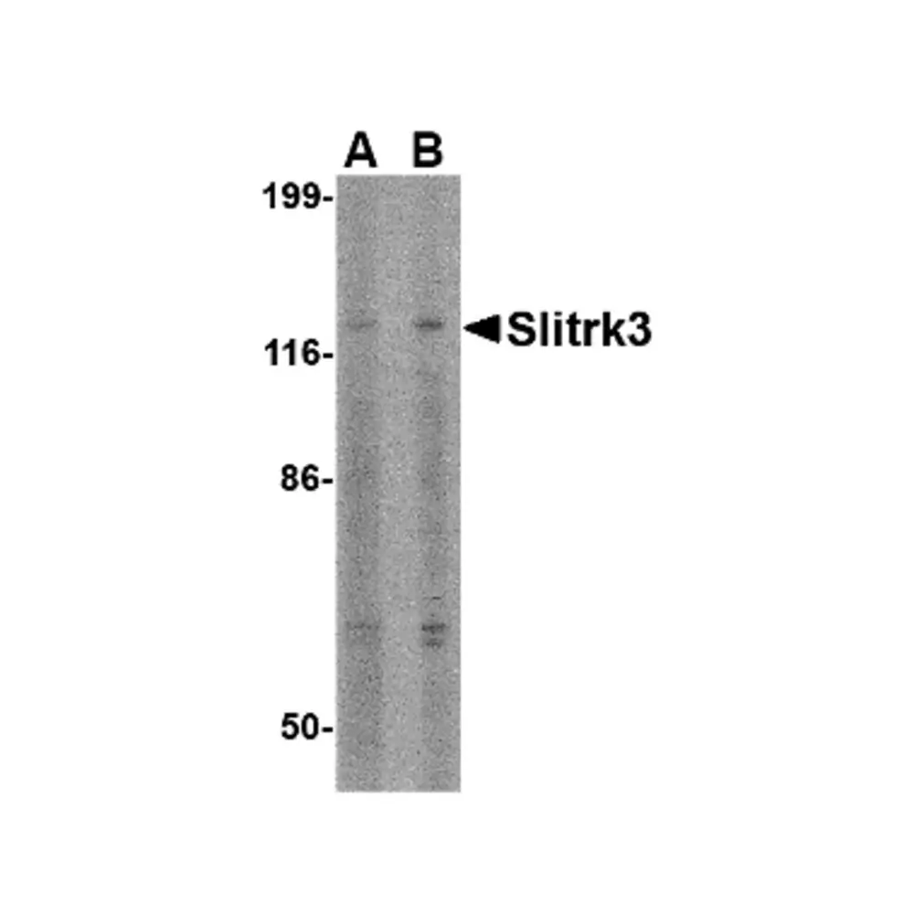 ProSci 4463 Slitrk3 Antibody, ProSci, 0.1 mg/Unit Primary Image