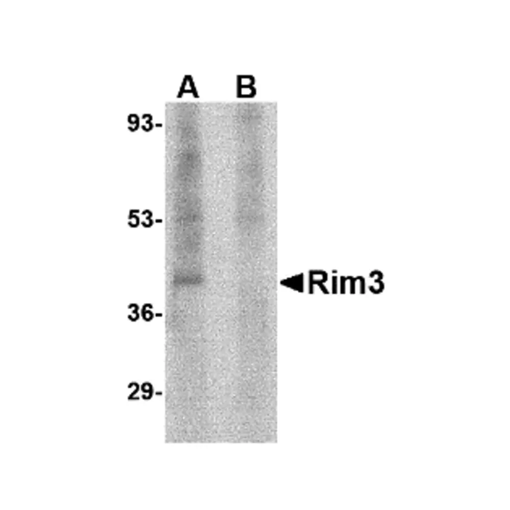 ProSci 4471 Rim3 Antibody, ProSci, 0.1 mg/Unit Primary Image