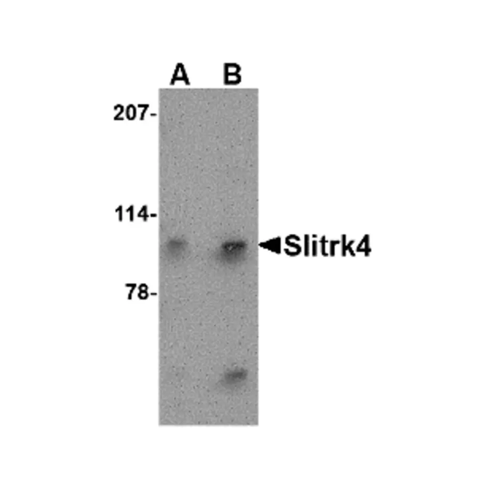 ProSci 4473 Slitrk4 Antibody, ProSci, 0.1 mg/Unit Primary Image