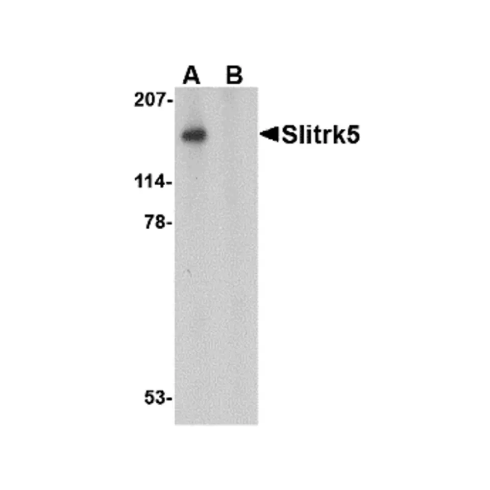 ProSci 4475 Slitrk5 Antibody, ProSci, 0.1 mg/Unit Primary Image
