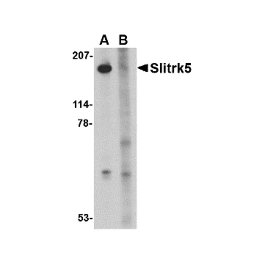 ProSci 4477 Slitrk5 Antibody, ProSci, 0.1 mg/Unit Primary Image