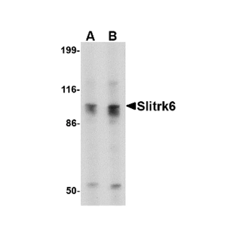 ProSci 4479_S Slitrk6 Antibody, ProSci, 0.02 mg/Unit Primary Image