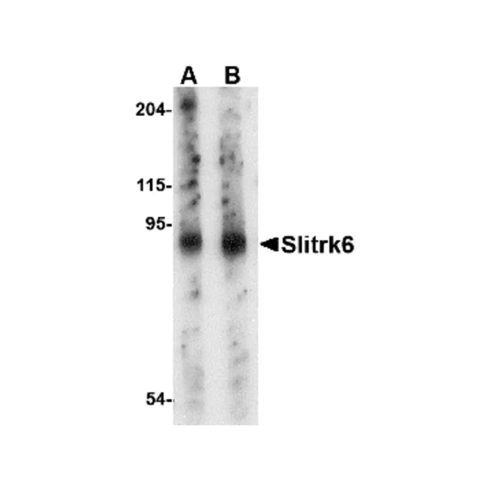 ProSci 4481 Slitrk6 Antibody, ProSci, 0.1 mg/Unit Primary Image