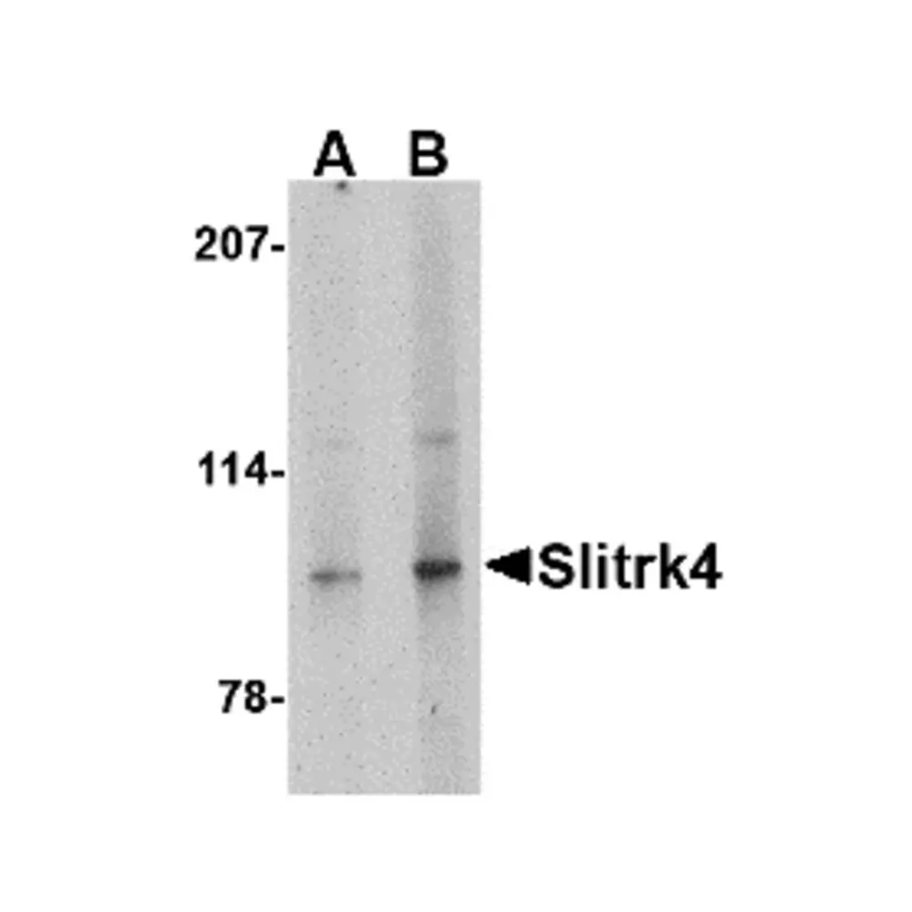 ProSci 4483_S Slitrk4 Antibody, ProSci, 0.02 mg/Unit Primary Image