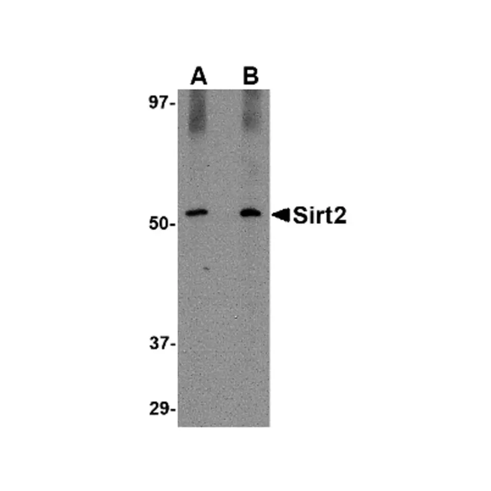 ProSci 4485 SIRT2 Antibody, ProSci, 0.1 mg/Unit Primary Image