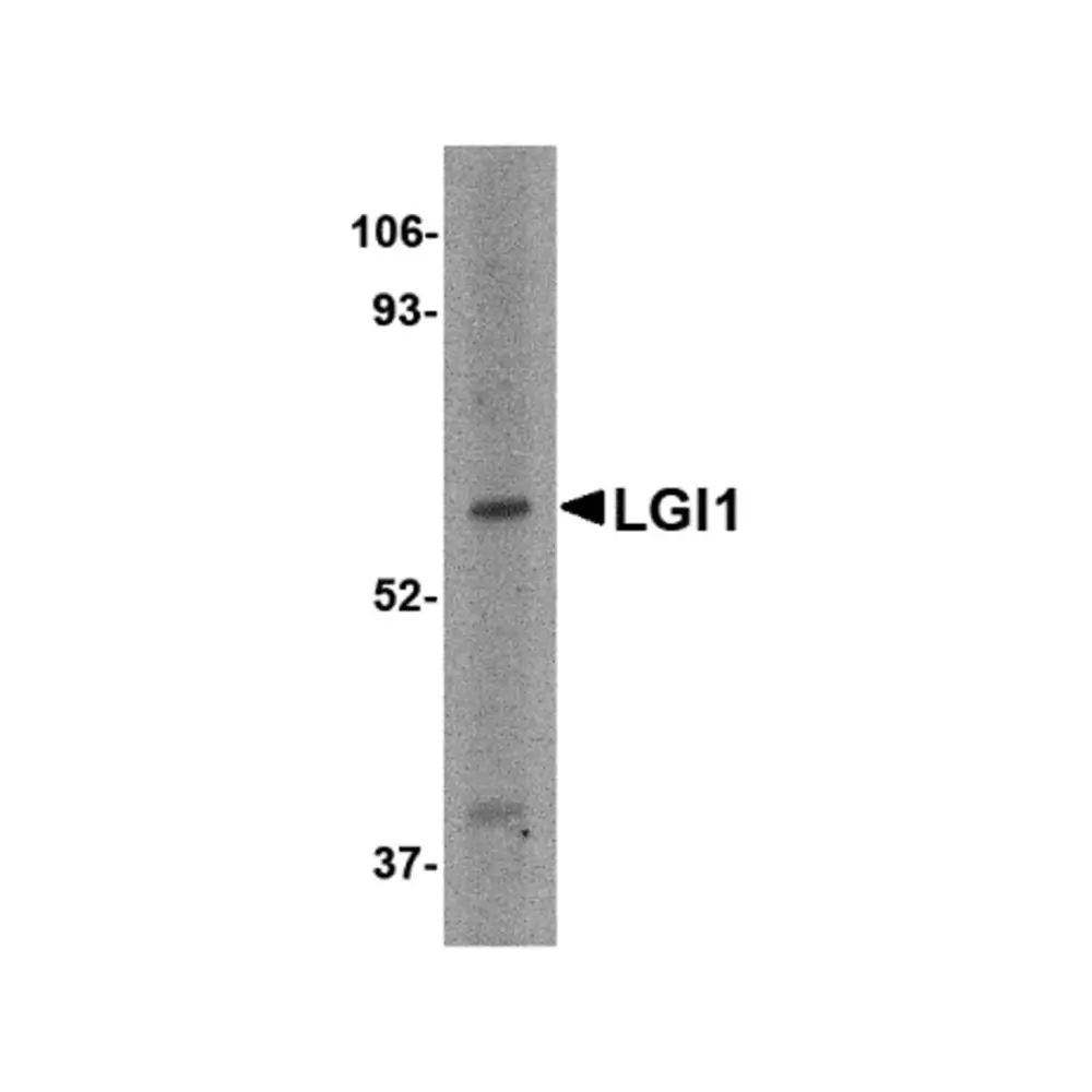 ProSci 4489 LGI1 Antibody, ProSci, 0.1 mg/Unit Primary Image