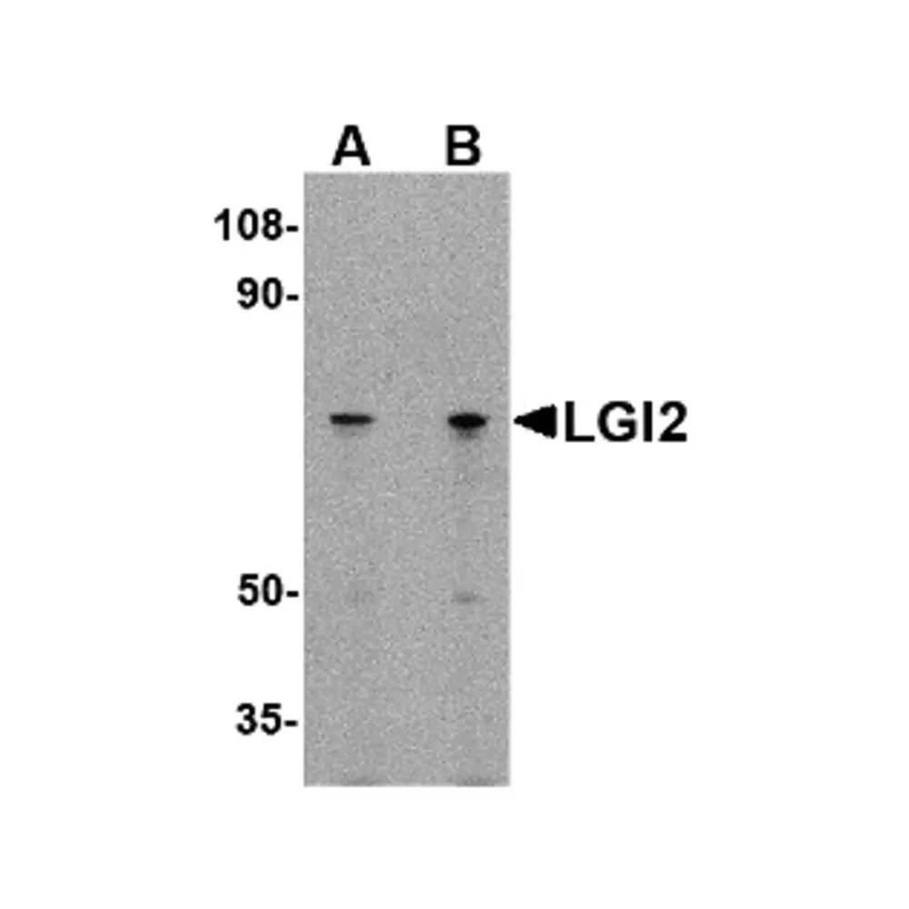 ProSci 4491_S LGI2 Antibody, ProSci, 0.02 mg/Unit Primary Image