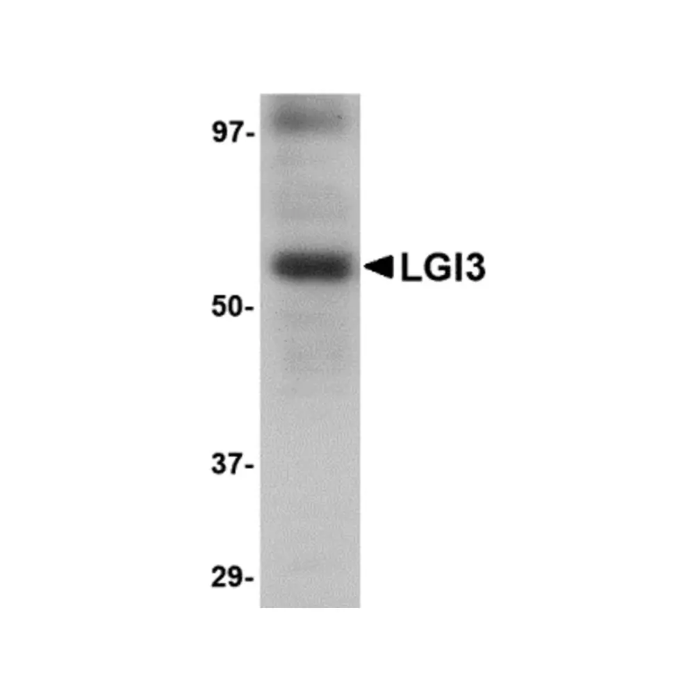 ProSci 4493 LGI3 Antibody, ProSci, 0.1 mg/Unit Primary Image