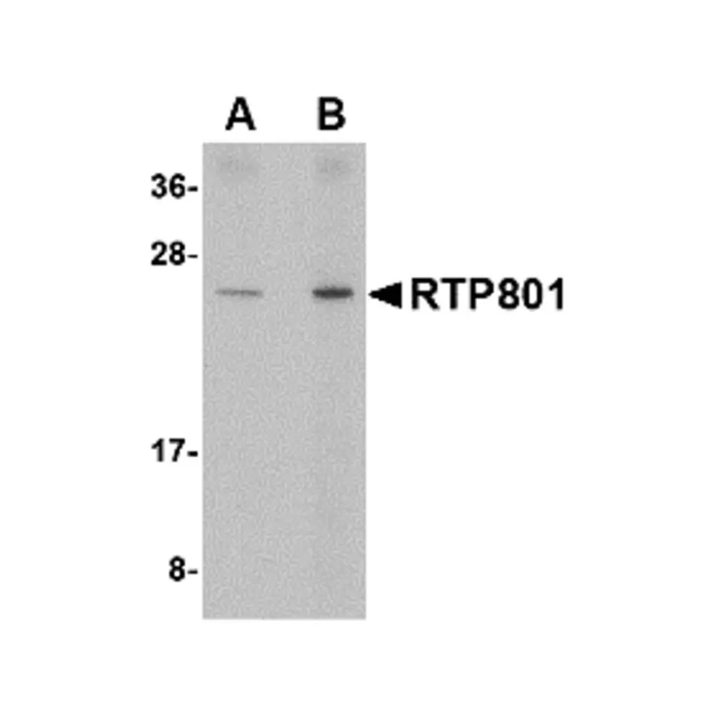 ProSci 4495_S RTP801 Antibody, ProSci, 0.02 mg/Unit Primary Image