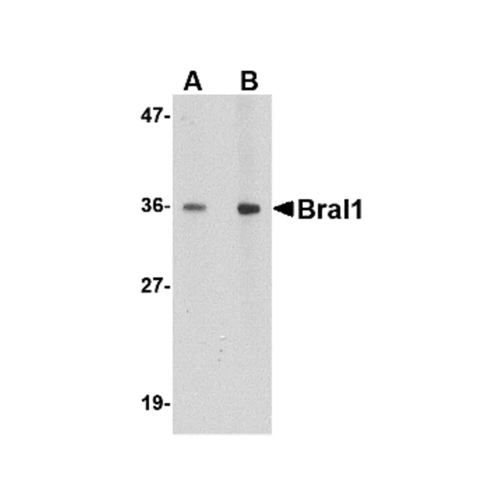 ProSci 4501_S BRAL1 Antibody, ProSci, 0.02 mg/Unit Primary Image
