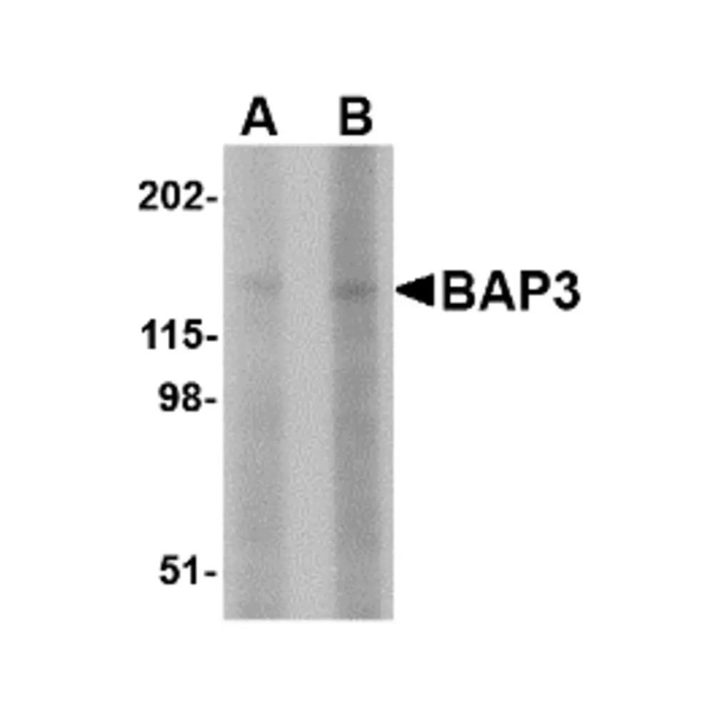 ProSci 4505 BAP3 Antibody, ProSci, 0.1 mg/Unit Primary Image