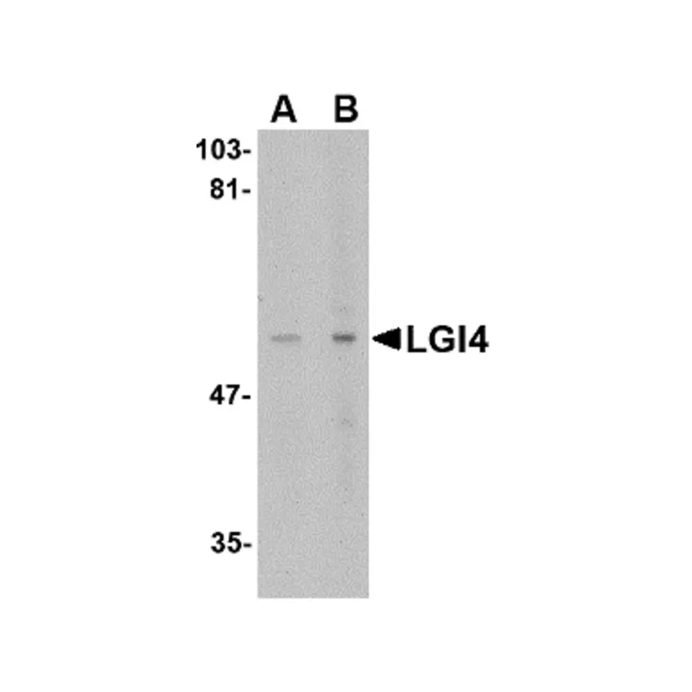 ProSci 4511 LGI4 Antibody, ProSci, 0.1 mg/Unit Primary Image