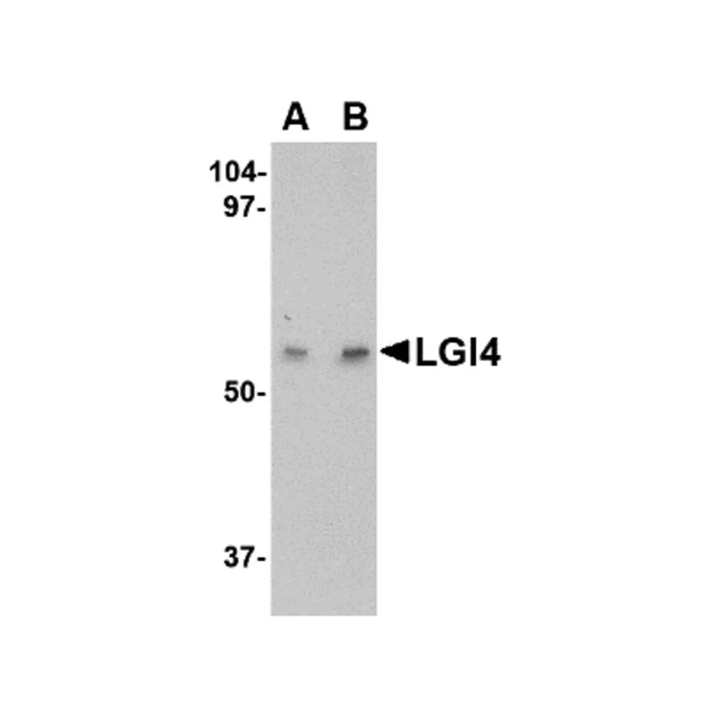 ProSci 4513 LGI4 Antibody, ProSci, 0.1 mg/Unit Primary Image