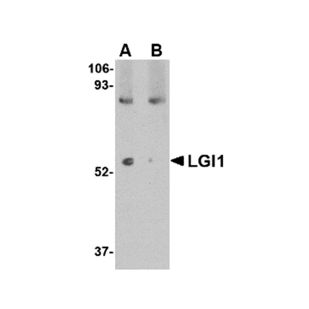 ProSci 4531 LGI1 Antibody, ProSci, 0.1 mg/Unit Primary Image