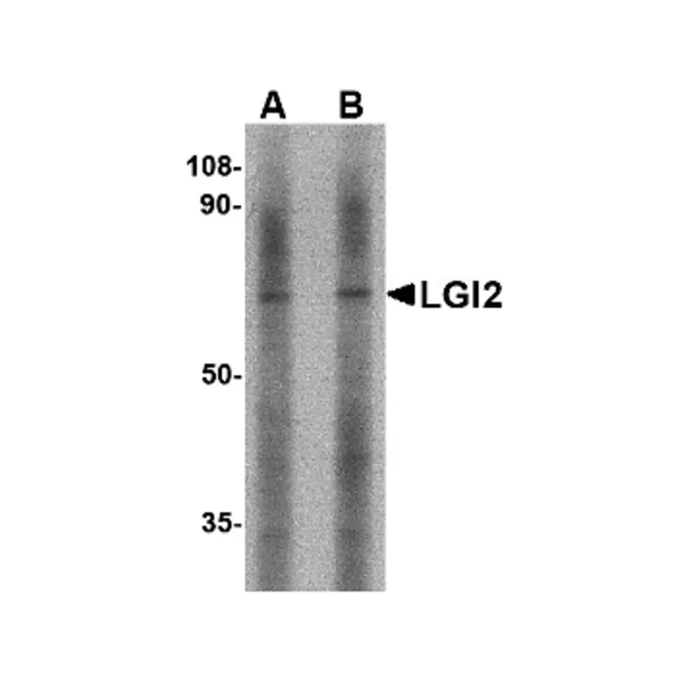 ProSci 4533_S LGI2 Antibody, ProSci, 0.02 mg/Unit Primary Image