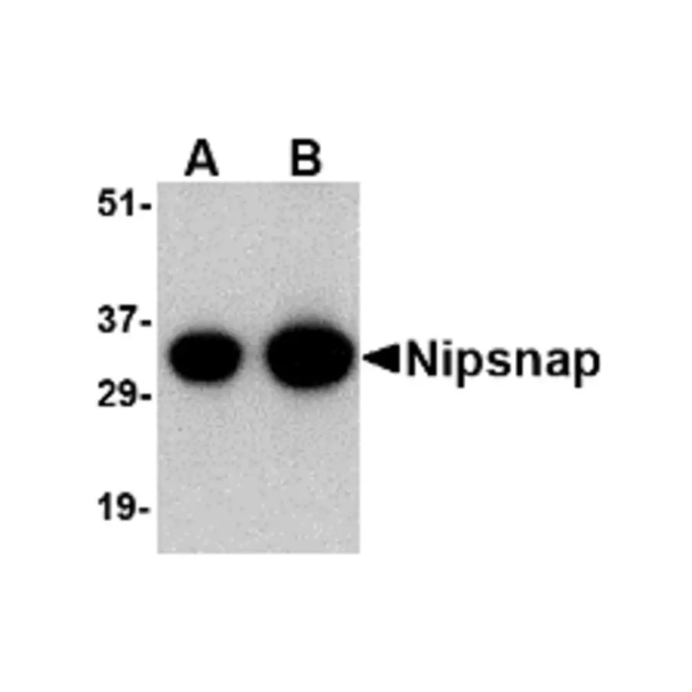 ProSci 4535 NIPSNAP Antibody, ProSci, 0.1 mg/Unit Primary Image