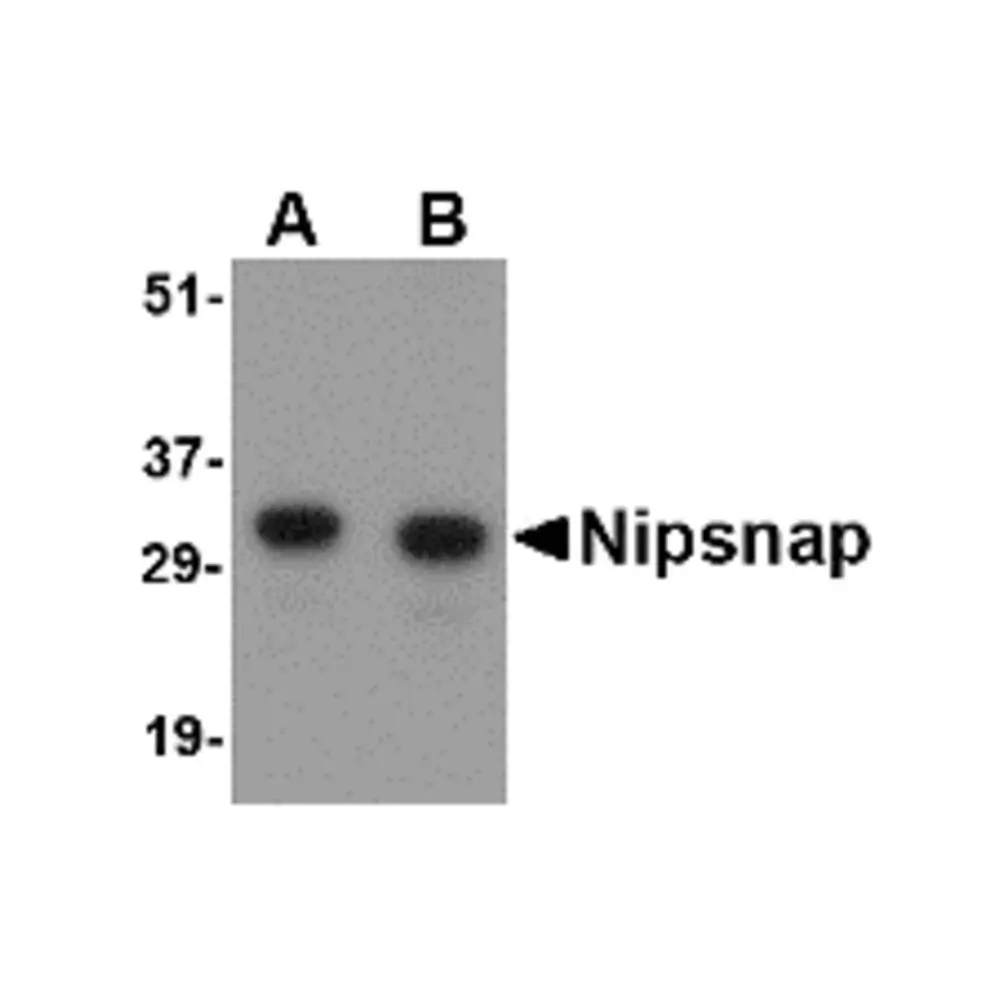 ProSci 4537 NIPSNAP Antibody, ProSci, 0.1 mg/Unit Primary Image